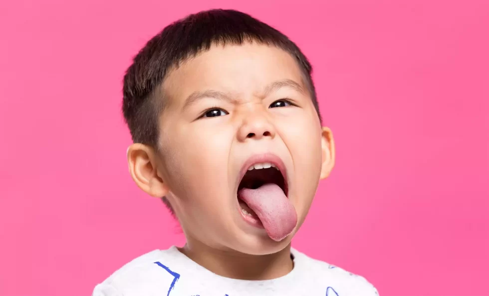 What are the benefits of good tongue posture?