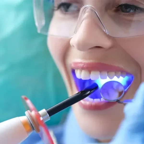 Dental Fillings Leeming Dental