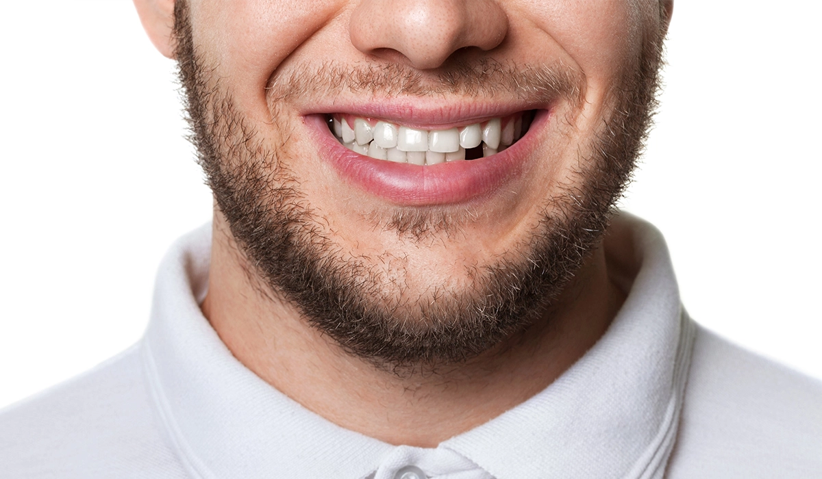 leeming-dental-blog-Why you can't afford to ignore gaps in your smile - missing-teeth Why you can't afford to ignore gaps in your smile