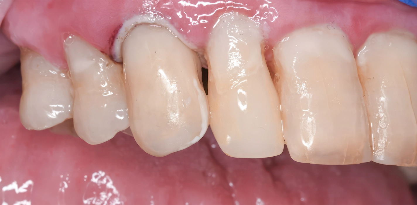 Characterisation Characterisation