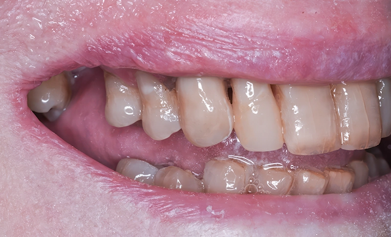 Patient Outcome Patient Outcome