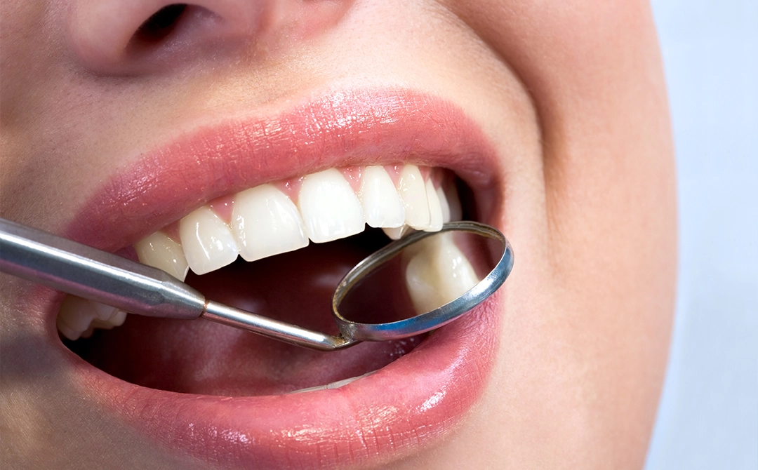 How biomimetic dentistry uses nature to restore and protect tooth enamel