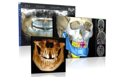 The future of artificial intelligence (AI) in dentistry