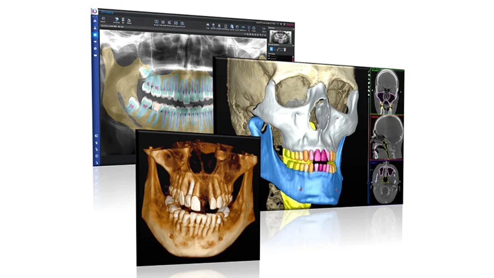 The future of artificial intelligence (AI) in dentistry